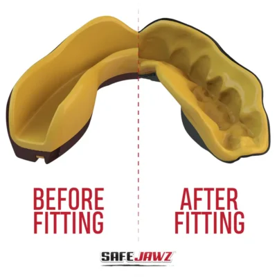 SafeJawz Extro Series Goldie Mouthguard 12 SafeJawz Extro Series Goldie Mouthguard -Fight Gloves Store Extro Goldie 4
