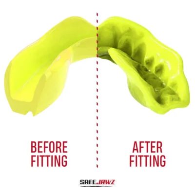 SafeJawz Intro Series Fluro Yellow Mouthguard 9 SafeJawz Intro Series Fluro Yellow Mouthguard -Fight Gloves Store Intro Fluro Yellow 3